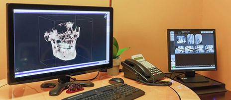 Digital rendering of a patient's teeth displayed on computer