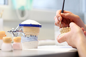 Dentist creating model of dental crowns