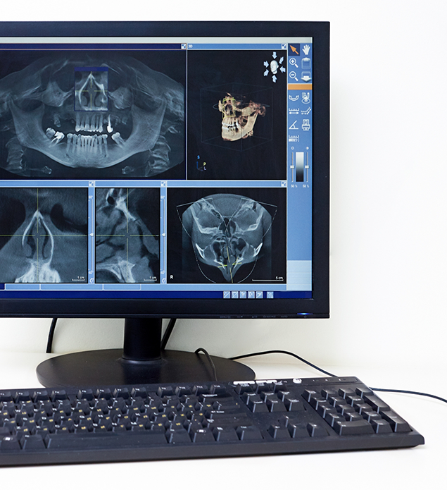 Computer monitor showing multiple x-rays of a patient's teeth and jaws