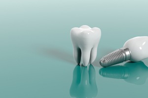 implant and tooth