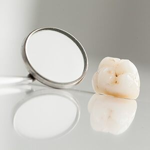 parks Single-Visit Dental crowns on table