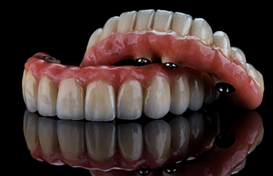 Set of implant dentures