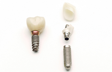 Dental implant with a crown and abutment piece