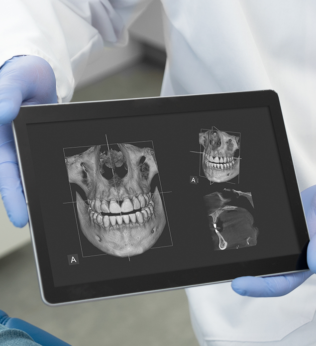 Dentist holding a tablet showing digital dental x-rays
