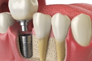 3D oral structures