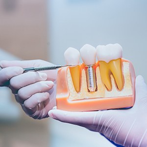 Close-up of dentist’s hands pointing to dental implant model