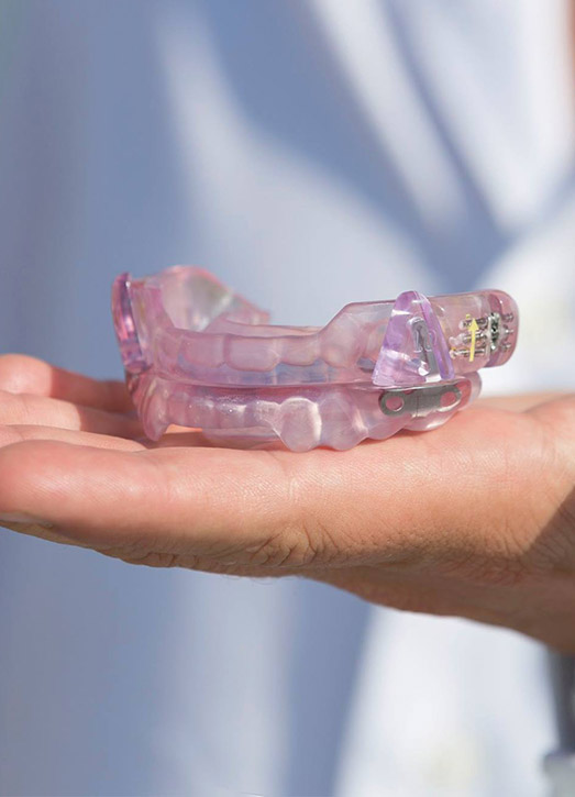 Hand holding a sleep apnea oral appliance