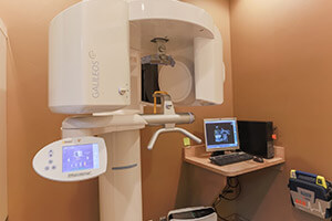 3D CT conebeam scanner