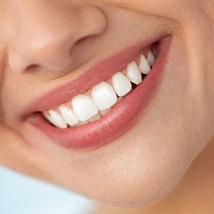 Woman smiling with white teeth