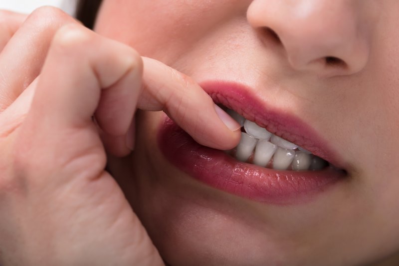 Closeup of woman biting her nails