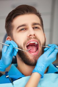 man with mouth open at dentist 