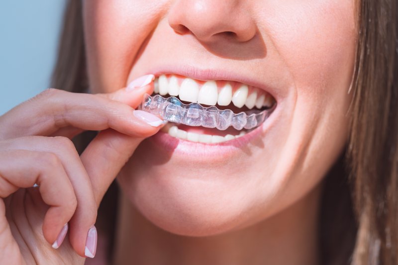 A woman placing SureSmile aligners on her teeth